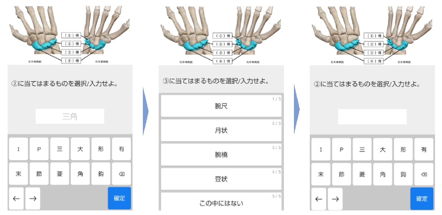 難易度調整